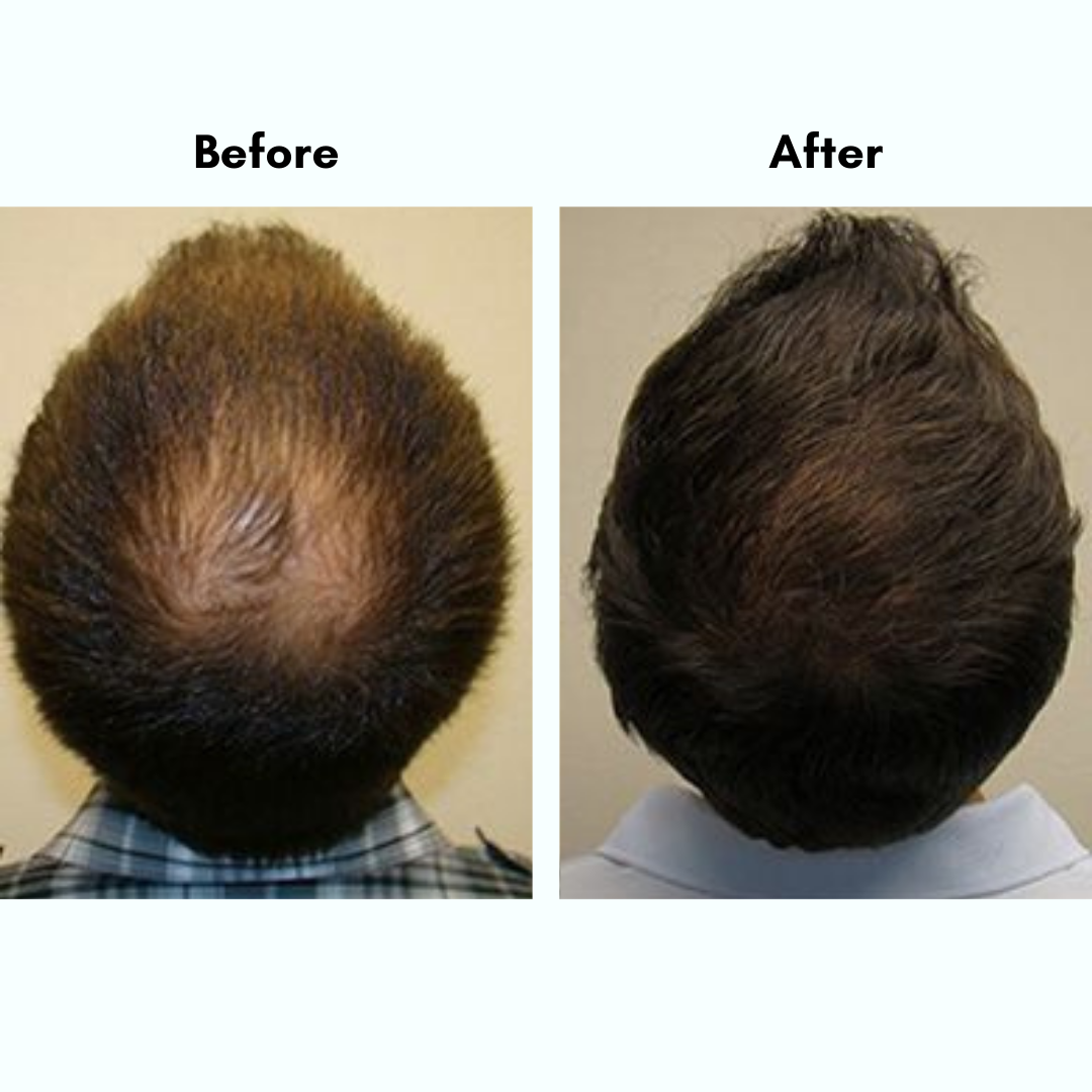 Amara Natural Hair Growth Oil