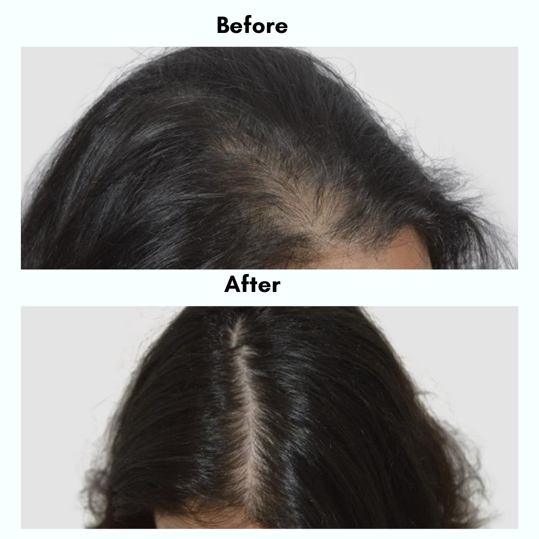Amara Natural Hair Growth Oil