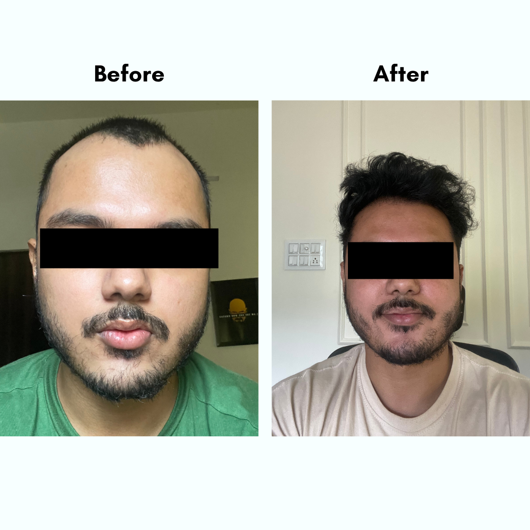 Amara Natural Hair Growth Oil - Backed by Science. Made for Men.