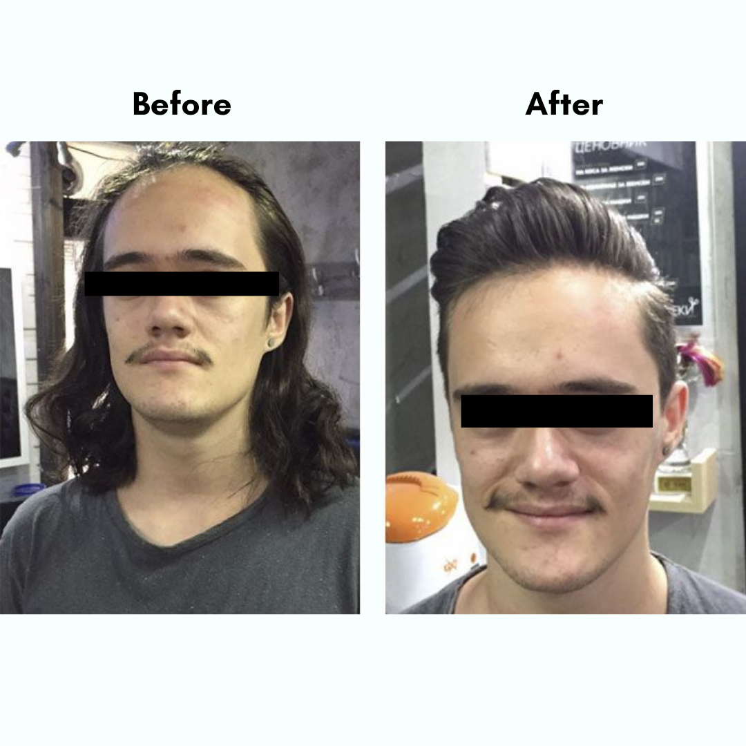 Amara Natural Hair Growth Oil - Backed by Science. Made for Men.