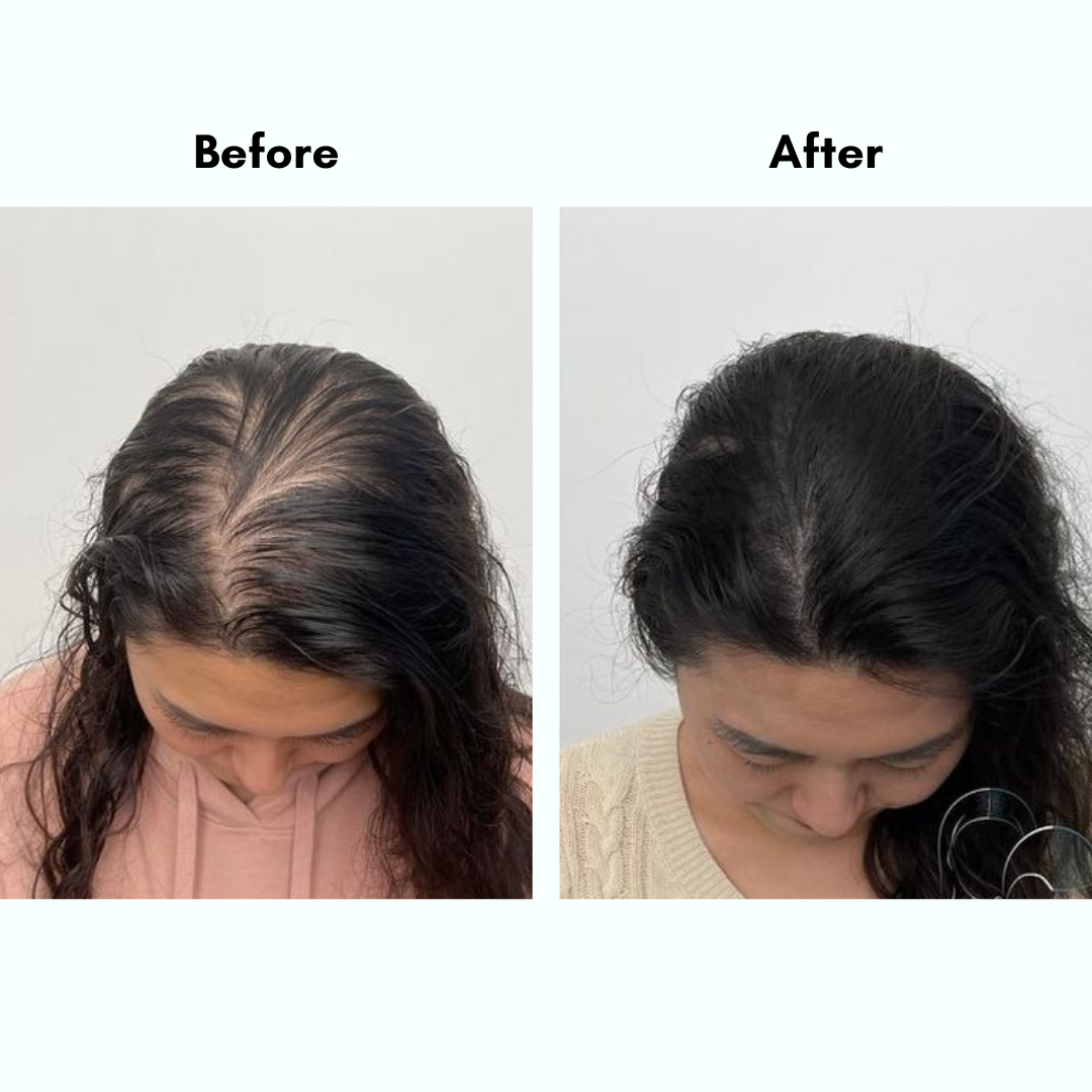 Amara Natural Hair Growth Oil